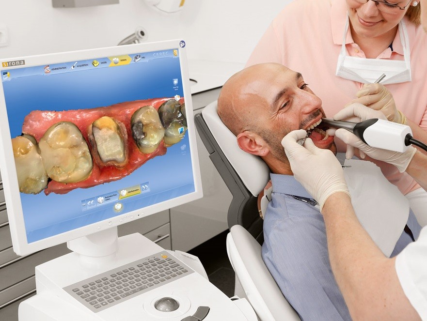 סריקת שיניים דיגיטלית במרפאה
